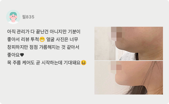 치료후기7