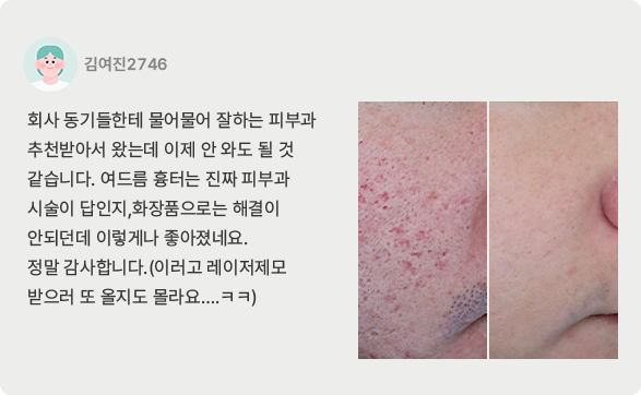 치료후기8