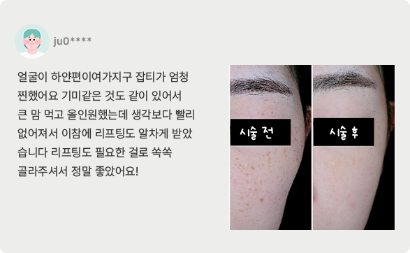 치료후기2