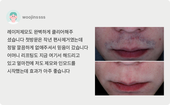 치료후기5