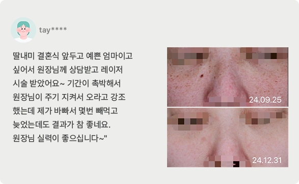 치료후기9