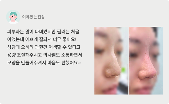 치료후기6