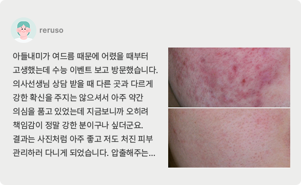 치료후기3