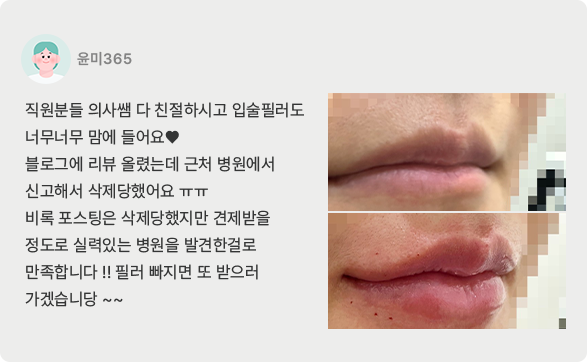 치료후기1